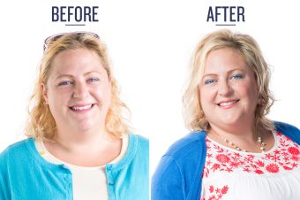 before and after photo