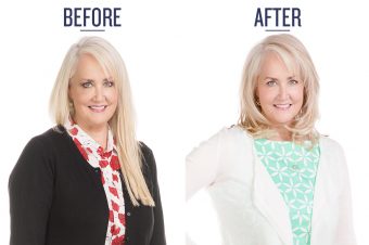 before and after photo