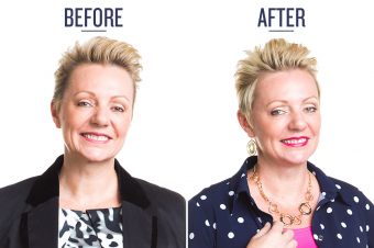 before and after photo