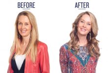 Type 3 Robyn Before & After