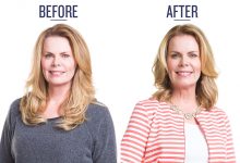before and after photo