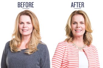 before and after photo