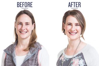 before and after photo