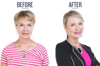 before and after photo