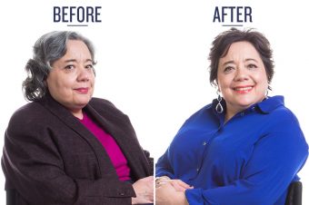 before and after photo