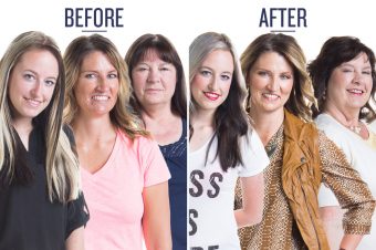 before and after photo