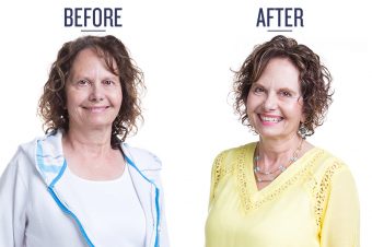 before and after photo