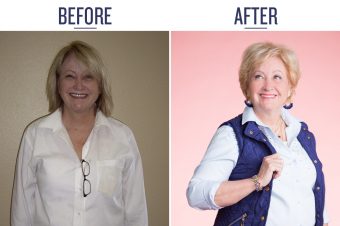 before and after photo