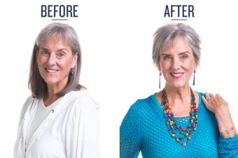 before and after photo