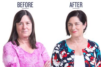 before and after photo