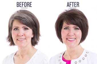 Before and after photo