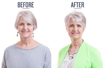 before and after photo