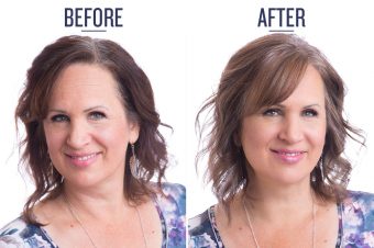 Before and after photo