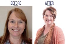 before and after photo