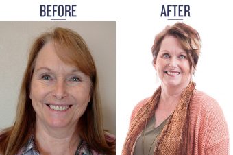 before and after photo