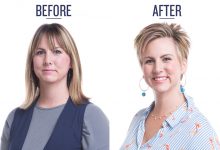 before and after photo