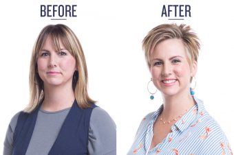 before and after photo