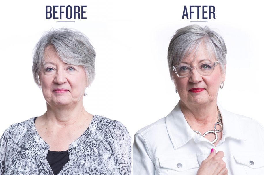before and after photo