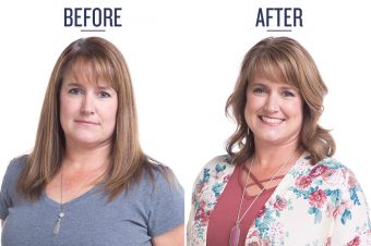 Before and after photo