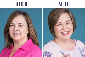 Before and After of Lisa