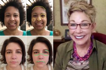 side by side pictures of women showing their face profiling features
