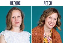 Before and After of Melissa