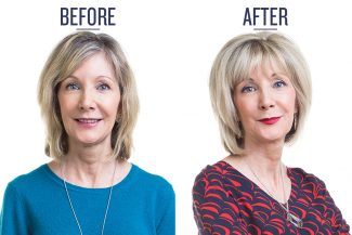 before and after photo