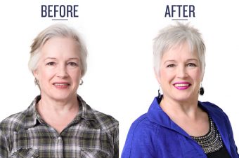 Before and After of woman