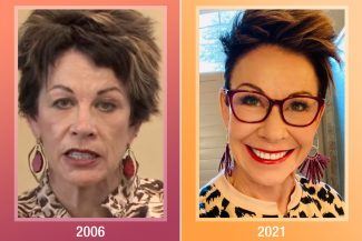 Before and after picture of Carol's skin
